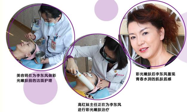 光子嫩肤有哪些副作用